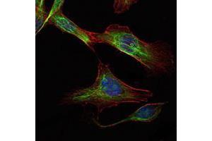 Immunofluorescence analysis of NIH/3T3 cells using RICTOR mouse mAb (green).