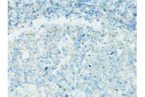 Immunohistochemistry of paraffin-embedded human vermiform appendix using CD19 antibody (ABIN5971402) at dilution of 1/100 (40x lens). (CD19 anticorps)
