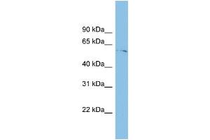 WB Suggested Anti-TINAGL1 Antibody Titration: 0. (TINAGL1 anticorps  (Middle Region))