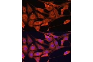 Immunofluorescence analysis of NIH/3T3 cells using ALDOC Rabbit pAb (ABIN6129897, ABIN6136788, ABIN6136789 and ABIN6215308) at dilution of 1:100.