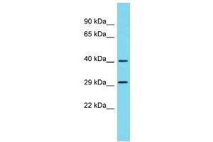 Host: Rabbit Target Name: METAP1D Sample Type: 293T Whole Cell lysates Antibody Dilution: 1. (MAP1D anticorps  (N-Term))