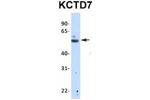 Host:  Rabbit  Target Name:  KCTD7  Sample Type:  Human Fetal Lung  Antibody Dilution:  1. (KCTD7 anticorps  (N-Term))