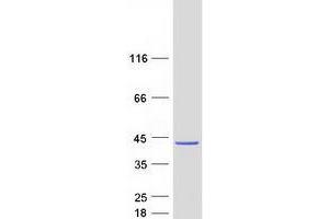 Validation with Western Blot