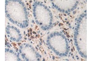 Detection of TNFa in Human Stomach Tissue using Polyclonal Antibody to Tumor Necrosis Factor Alpha (TNFa) (TNF alpha anticorps  (AA 77-233))