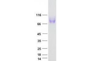 Validation with Western Blot