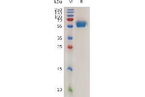 Mouse Protein, His Tag on SDS-PAGE under reducing condition.