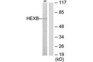 Western Blotting (WB) image for anti-Hexosaminidase B (Beta Polypeptide) (HEXB) (AA 481-530) antibody (ABIN2879138) (HEXB anticorps  (AA 481-530))