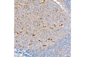 Immunohistochemistry of paraffin-embedded Human tonsil using CD63 antibody (ABIN7266210) at dilution of 1:200 (40x lens). (CD63 anticorps)