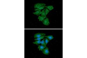 ICC/IF analysis of TUBG1 in HeLa cells. (TUBG1 anticorps)