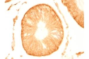 Formalin-fixed, paraffin-embedded Rat Testis stained with Pgp9. (UCHL1 anticorps)