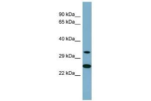 PRKAB2 antibody used at 1 ug/ml to detect target protein. (PRKAB2 anticorps  (Middle Region))