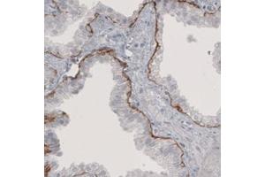 Immunohistochemical staining (Formalin-fixed paraffin-embedded sections) of human prostate with LAMB3 monoclonal antibody, clone CL3353  shows immunoreactivity in basement membrane of glandular epithelium. (Laminin beta 3 anticorps)