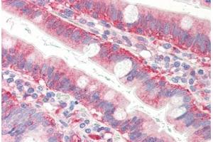 Human Small Intestine (formalin-fixed, paraffin-embedded) stained with CFL1 antibody ABIN364365 at 10 ug/ml followed by biotinylated anti-mouse IgG secondary antibody ABIN481714, alkaline phosphatase-streptavidin and chromogen. (Cofilin anticorps  (AA 1-166))