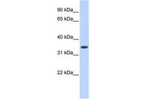 Image no. 1 for anti-Tripartite Motif Containing 27 (TRIM27) (AA 141-190) antibody (ABIN6744473) (TRIM27 anticorps  (AA 141-190))
