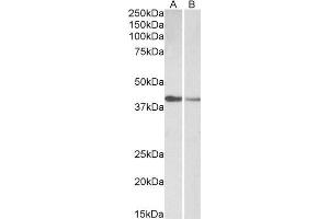ABIN2613399 (0. (Cardiac Troponin T2 anticorps  (AA 201-213))