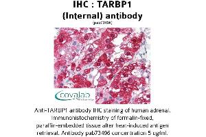Image no. 2 for anti-TAR (HIV-1) RNA Binding Protein 1 (TARBP1) (Internal Region) antibody (ABIN1739905) (TARBP1 anticorps  (Internal Region))