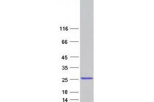 Validation with Western Blot
