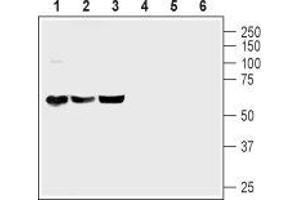 Western blot analysis of mouse brain (lanes 1 and 4), rat brain (lanes 2 and 5) and rat cerebellum (lanes 3 and 6) lysates: - 1-3. (ADCYAP1R1 anticorps  (C-Term, Intracellular))