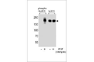 Western blot analysis of extracts from A431 cell, untreated or treated with EGF, using phospho-EGFR-p (left) or ErBB2 antibody (right). (EGFR anticorps  (pSer1070))