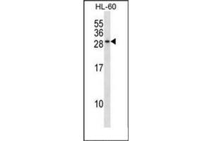 Western blot analysis of RAB15 Antibody (Center) in HL-60 cell line lysates (35ug/lane). (RAB15 anticorps  (Middle Region))