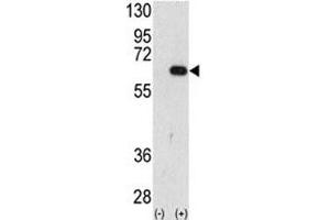 Western blot analysis of AMFR antibody and 293 cell lysate (2 ug/lane) either nontransfected (Lane 1) or transiently transfected with the AMFR gene (2). (AMFR anticorps  (AA 571-601))