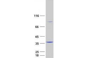 Validation with Western Blot