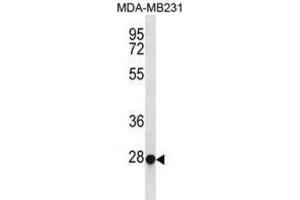Western Blotting (WB) image for anti-Transcription Factor EC (TFEC) antibody (ABIN3000962) (TFEC anticorps)