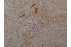 IHC-P analysis of Human Liver Tissue, with DAB staining.