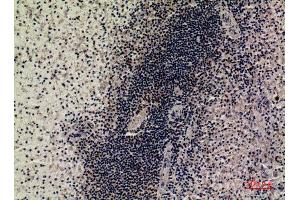 Immunohistochemistry (IHC) analysis of paraffin-embedded Human Spleen, antibody was diluted at 1:100.
