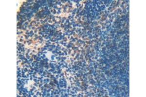 Detection of LOXL3 in Mouse Spleen Tissue using Polyclonal Antibody to Lysyl Oxidase Like Protein 3 (LOXL3)