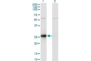 Western Blot analysis of TK1 expression in transfected 293T cell line by TK1 monoclonal antibody (M11), clone 2A2. (TK1 anticorps  (AA 1-234))