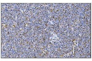 IHC analysis of MERTK using anti-MERTK antibody (ABIN7600623). (MERTK anticorps  (AA 21-489))