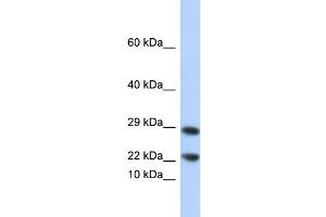 WB Suggested Anti-LCN8 Antibody Titration: 0. (LCN8 anticorps  (N-Term))