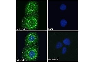 ABIN185361 Immunofluorescence analysis of paraformaldehyde fixed A431 cells, permeabilized with 0. (Lipin 2 anticorps  (C-Term))