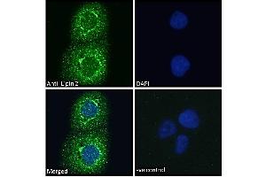ABIN185361 Immunofluorescence analysis of paraformaldehyde fixed A431 cells, permeabilized with 0. (Lipin 2 anticorps  (C-Term))