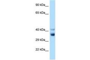 Image no. 1 for anti-NEK7 (NEK7) (C-Term) antibody (ABIN6748080) (NEK7 anticorps  (C-Term))