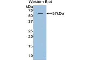 Western blot analysis of the recombinant protein. (ALDH7A1 anticorps  (AA 28-539))