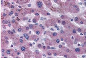 Human Liver (formalin-fixed, paraffin-embedded) stained with F7 antibody ABIN481753 at 5 ug/ml followed by biotinylated secondary antibody, alkaline phosphatase-streptavidin and chromogen. (Factor VII anticorps)