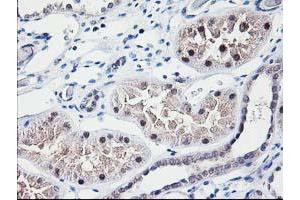 Immunohistochemical staining of paraffin-embedded Human Kidney tissue using anti-NUBPL mouse monoclonal antibody. (NUBPL anticorps  (AA 1-250))
