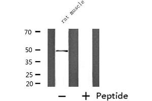 Western blot analysis of extracts from rat muscle, using PPARD Antibody. (PPARD anticorps  (C-Term))