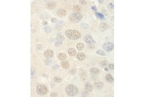 Immunohistochemistry (IHC) image for anti-WD Repeat Domain 5 (WDR5) (AA 50-100) antibody (ABIN7448863)