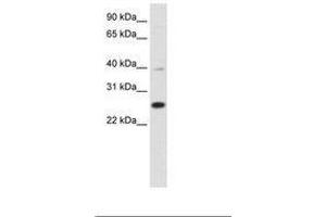 Image no. 1 for anti-YY1 Associated Factor 2 (YAF2) (C-Term) antibody (ABIN6736123) (YAF2 anticorps  (C-Term))