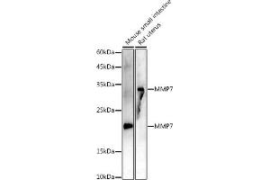 Western blot analysis of extracts of various cell lines, using MMP7 antibody (ABIN7268425 ) at 1:1000 dilution. (MMP7 anticorps)