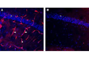 Expression of Aquaporin 4 in mouse hippocampus.