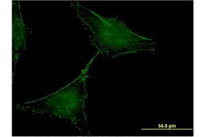Immunofluorescence of monoclonal antibody to SLAMF7 on HeLa cell.