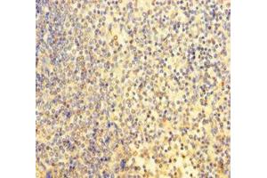 Immunohistochemistry of paraffin-embedded human spleen tissue using ABIN7164055 at dilution of 1:100 (POU3F2 anticorps  (AA 1-443))