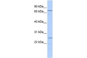 WB Suggested Anti-GALNT14 Antibody Titration:  0. (GALNT14 anticorps  (Middle Region))
