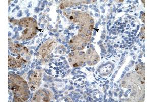ZNF258 antibody was used for immunohistochemistry at a concentration of 4-8 ug/ml to stain Epithelial cells of renal tubule (arrows) in Human Kidney. (ZMYM6 anticorps  (Middle Region))