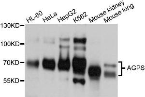 Western blot analysis of extracts of various cells, using AGPS antibody. (AGPS anticorps)