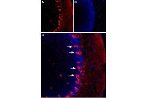 Expression of HCN1 in rat cerebellumImmunohistochemical staining of rat cerebellum using Guinea pig Anti-HCN1 Antibody (ABIN7043277, ABIN7045448 and ABIN7045449).